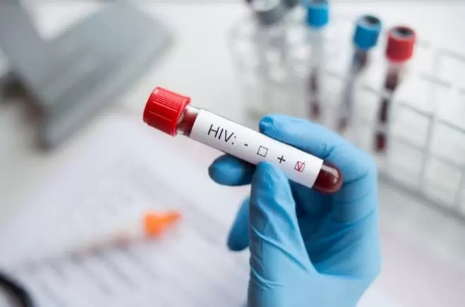 Hiv Test